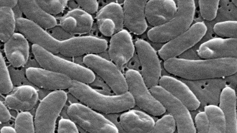 ARCHIVO - Esta imagen del microscopio electrónico de 2005 proporcionada por los Centros para...