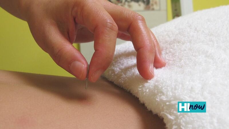 HMAA partners with Maunakea Acupuncture to help members relieve stress