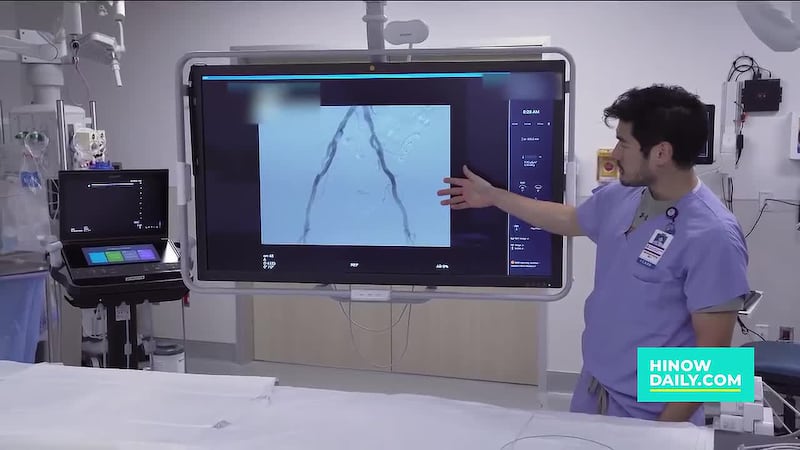 Interventional Radiology – Non-Surgical Treatment of Enlarged Prostates