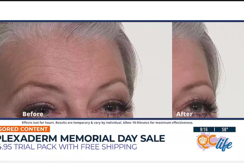 Memorial Day Sale: Get Plexaderm for less